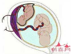 福州供卵代怀试管婴儿，福州治疗卵巢早衰医院有哪些
